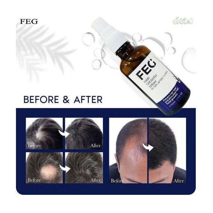 Fast Hair Growth Serum            مصل نمو الشعر السريع